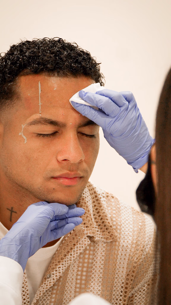 Toxina botulínica en Criolab Bogotá y Medellín — tratamiento facial para rostro fresco