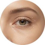 Debajo de los ojos