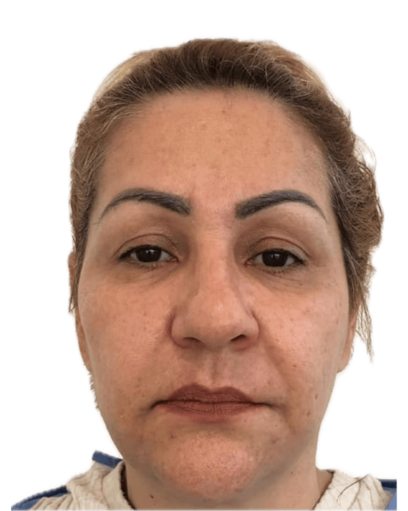 Después