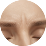 Entrecejo