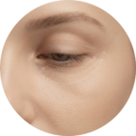 Ojeras