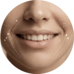 Sonrisa gingival